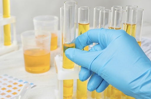 Urine