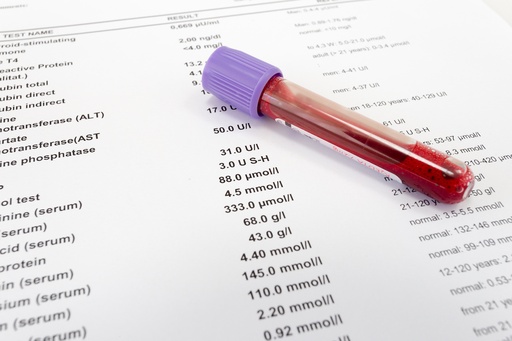 Colesterolo (totale,hdl,ldl,trigliceridi) 